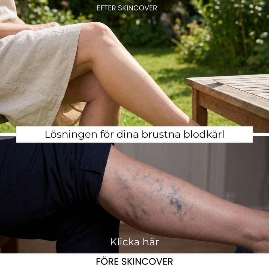 Näin se näyttää oikealla iholla